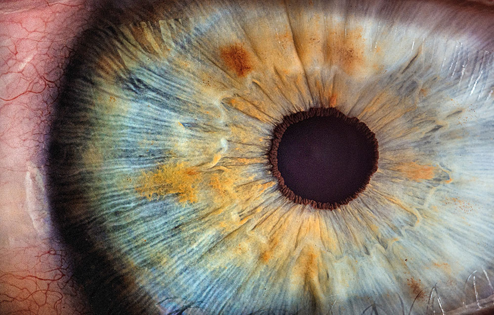 närbild på pupillen i ett öga