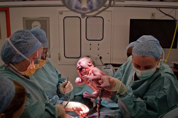 En förlossning med kejsarsnitt där bebis precis fått träffa omvärlden. Foto: Salim Fadhley