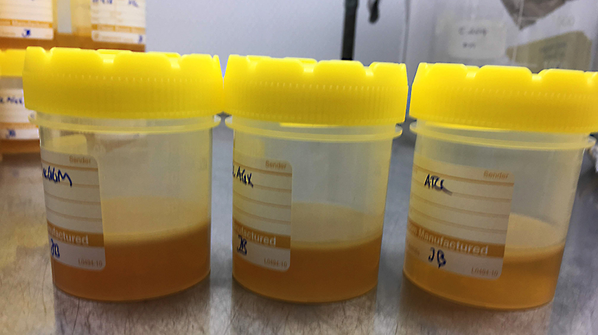 Three sealed containers containing gel in which hemicelluloses have been isolated for observation. 