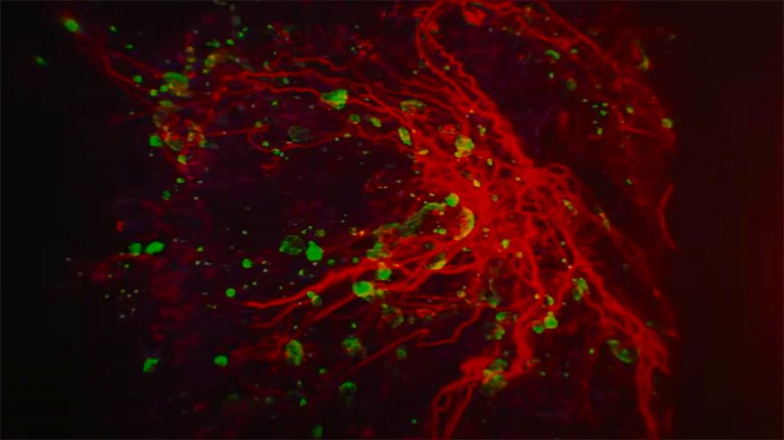The proteins involved in narcolepsy are shown in this still from a 3D animation