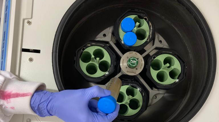 A centrifuge is loaded with sewage water samples
