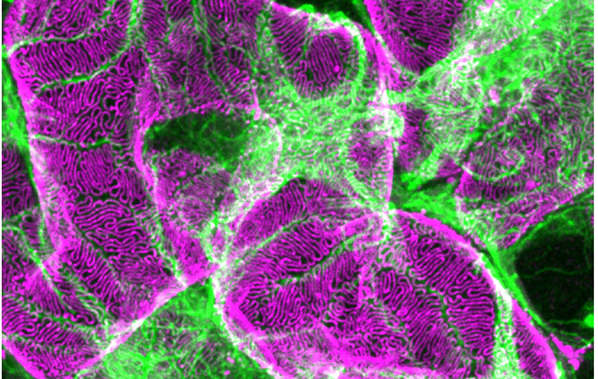 Filtration structure in kidney through 3D microscopy