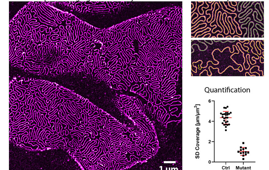 Via 3D microscopy, the filtration structure of the kidney