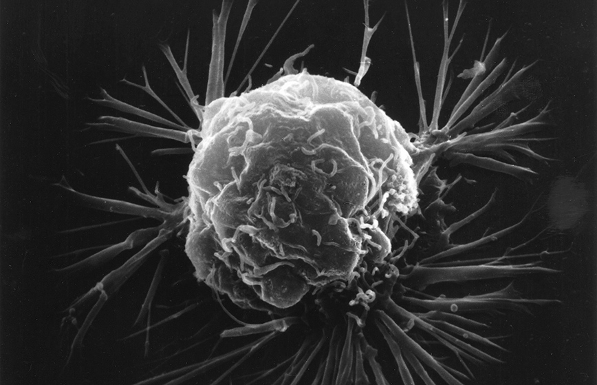 microscopic image of cancer cell