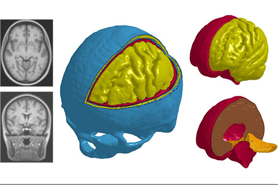 3D models of a brain.
