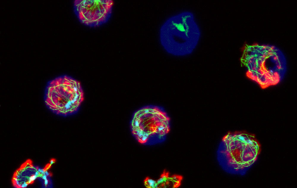 fluorescensmikroskopi gör att cellerna blir väldigt färgglada