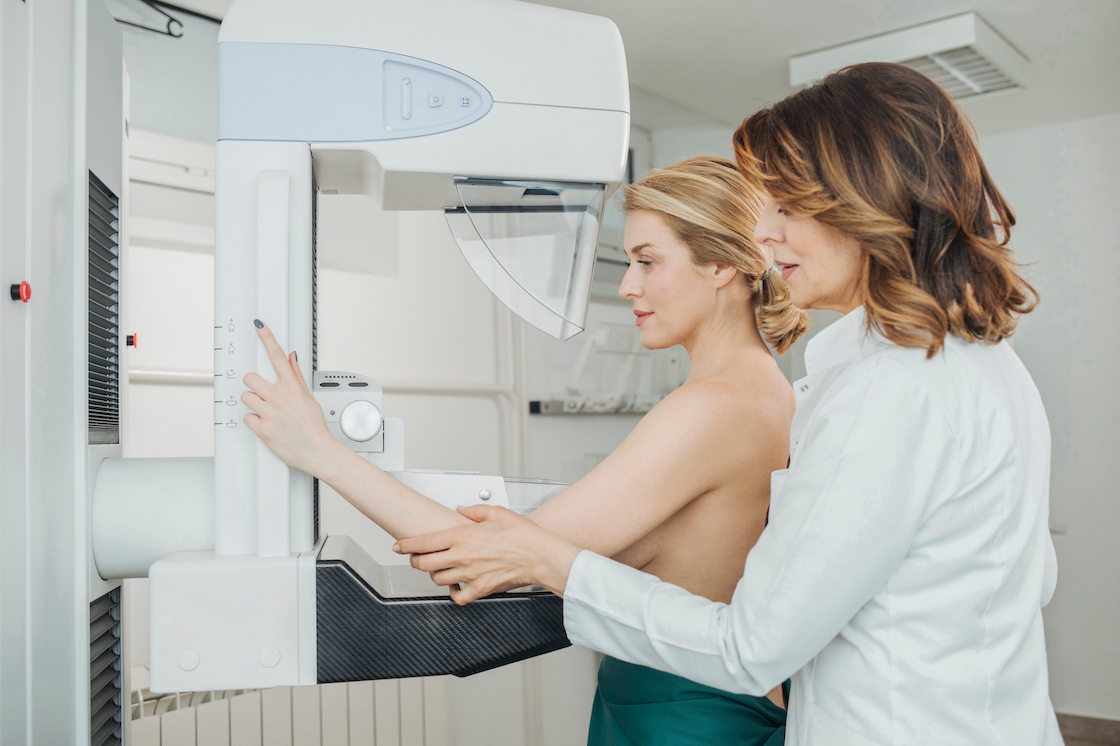 Mammografiscreening