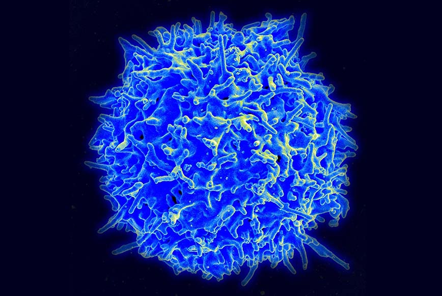En mänsklig T-cell från en frisk donator infångad av ett elektronmikroskop