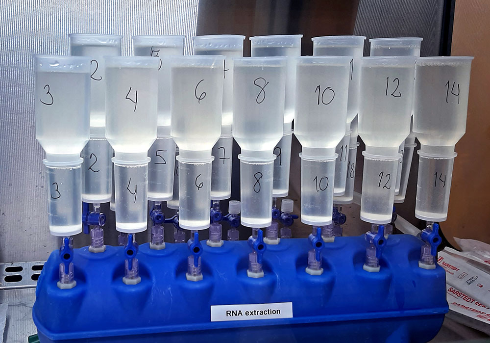 Test tubes filled with clear fluid stand side by side on plastic holder