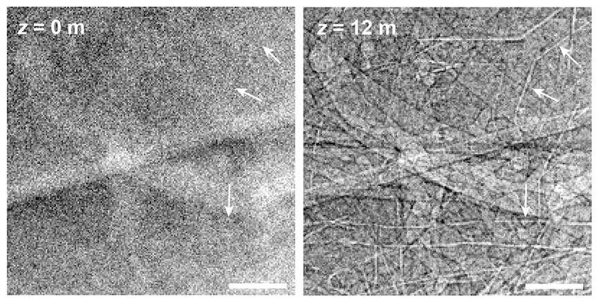 2 different X-ray images of same chest, side by side, with different resolution of detail.