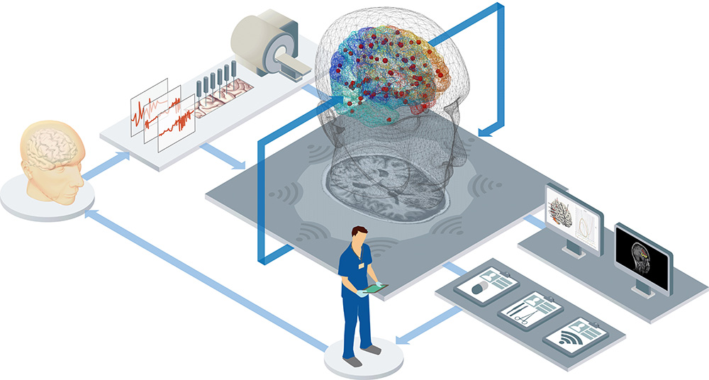 Grafisk bild med forskare, datorer, röntgenapparat och modeller av hjärna.