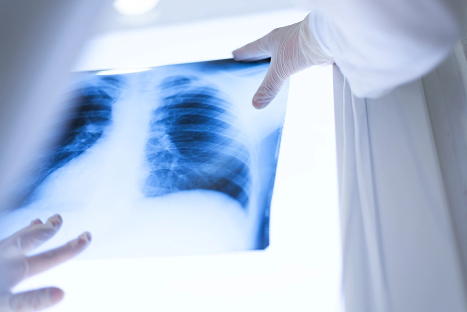 X-ray