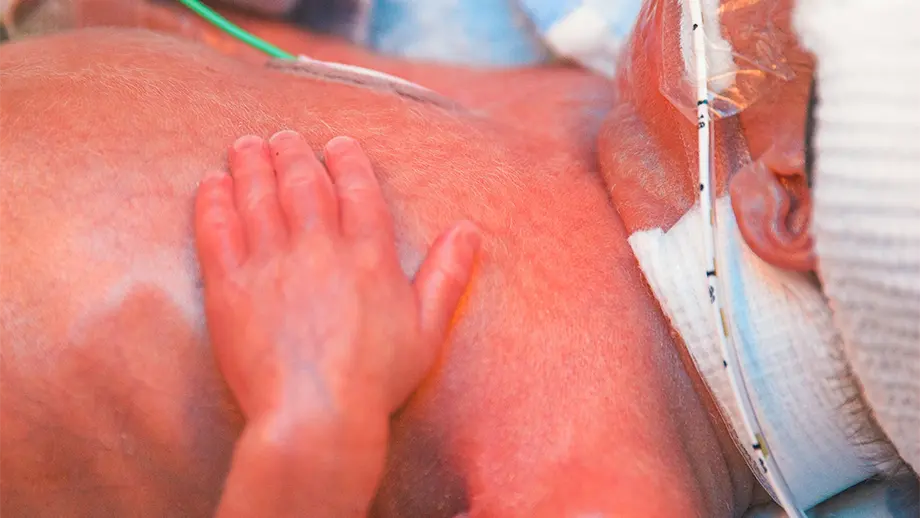 Premature baby resting in hospital ward