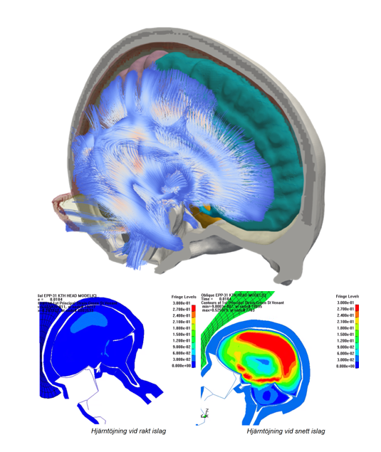 Illustrations of brains