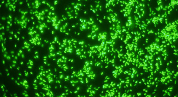 Bacteroides ovatus är en magbakterie som effektivt spjälkar upp kostfiber som vi äter. Forskarna har kartlagt hur det går till genom att studera en nyligen upptäckt gensekvens som ger bakterien förmågan att bryta ned en komponent som ofta finns i kostfiber.(Photo: Dr. Eric Martens, University of Michigan) 