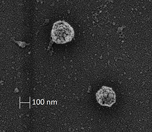 Svart-vit mikroskopisk bild som visar två exosomer på en svart yta.